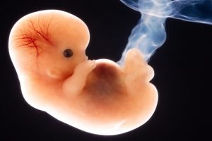 Male human fetus.